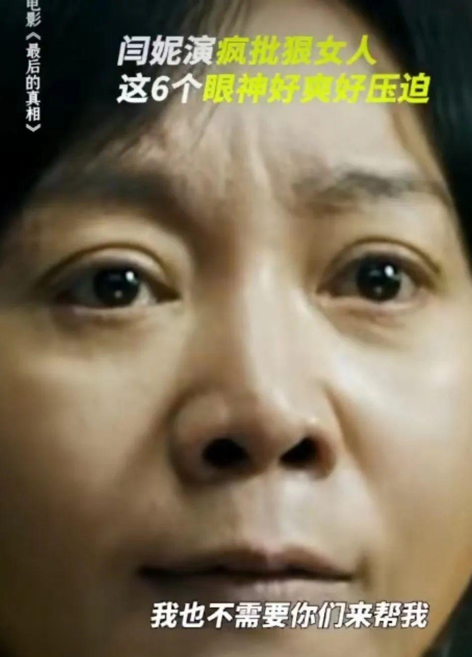 52岁闫妮参加活动,脸僵浮肿像蜡像,眼皮耷拉睁不开