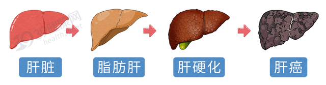 全球近一半肝癌在中国，再三提醒：家中的3种食物，尽早撤下餐桌