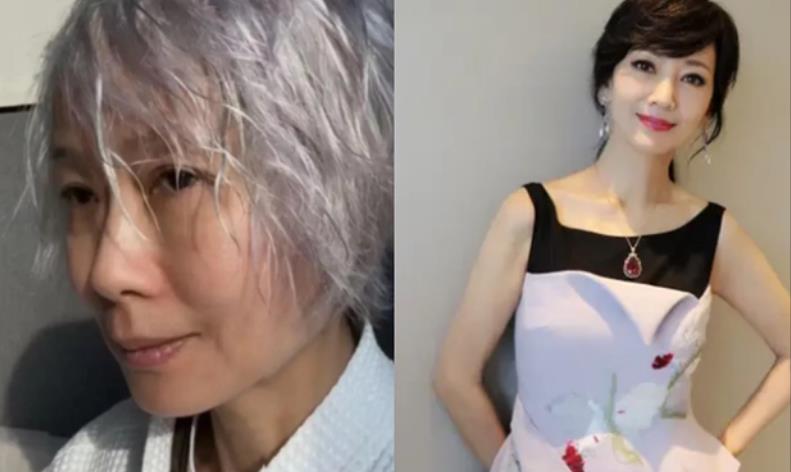 69岁赵雅芝对比60岁叶童,自然老去和医美老去的差距,一目了然