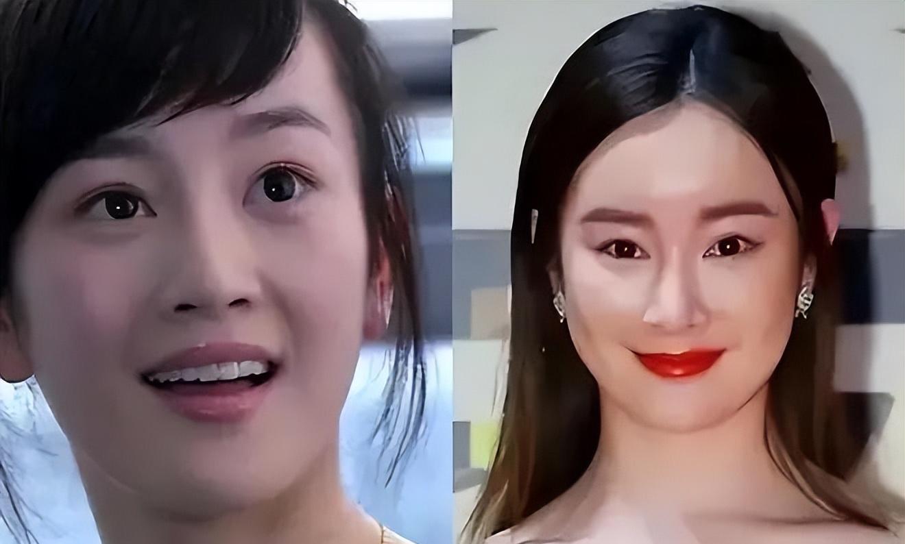 于正曝张檬取出整容“假体”并戒酒,晒新剧角色照,颜值看懵网友