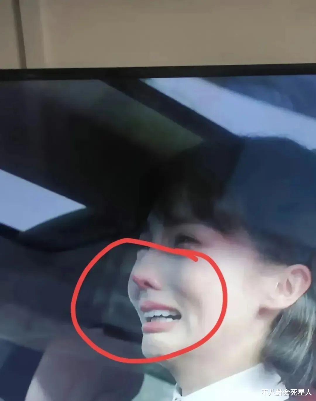 科技脸和自然脸的区别有多大?看看这7组明星的对比,就知道了?