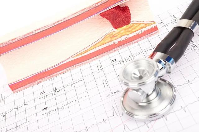 这些症状提醒你该查血脂了！附控血脂饮食指南→