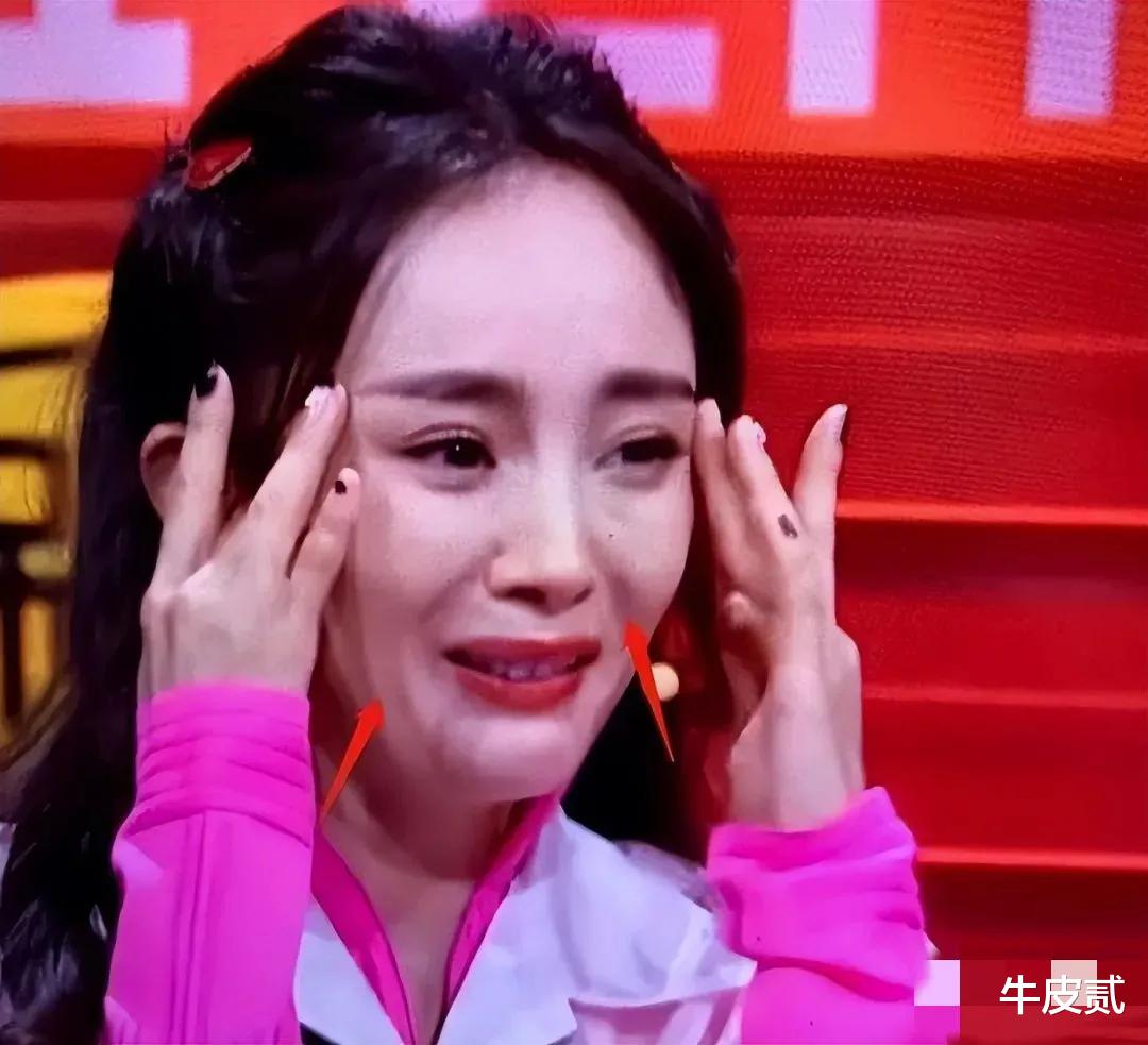 整容|有种倔强叫“我没整容”！明明从大饼脸变成V脸，真当观众瞎吗？