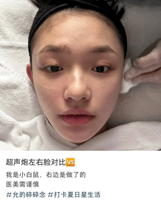 宁静扎900针,倪萍鼻孔外翻,明星里的打针族,掀开了娱圈遮羞布