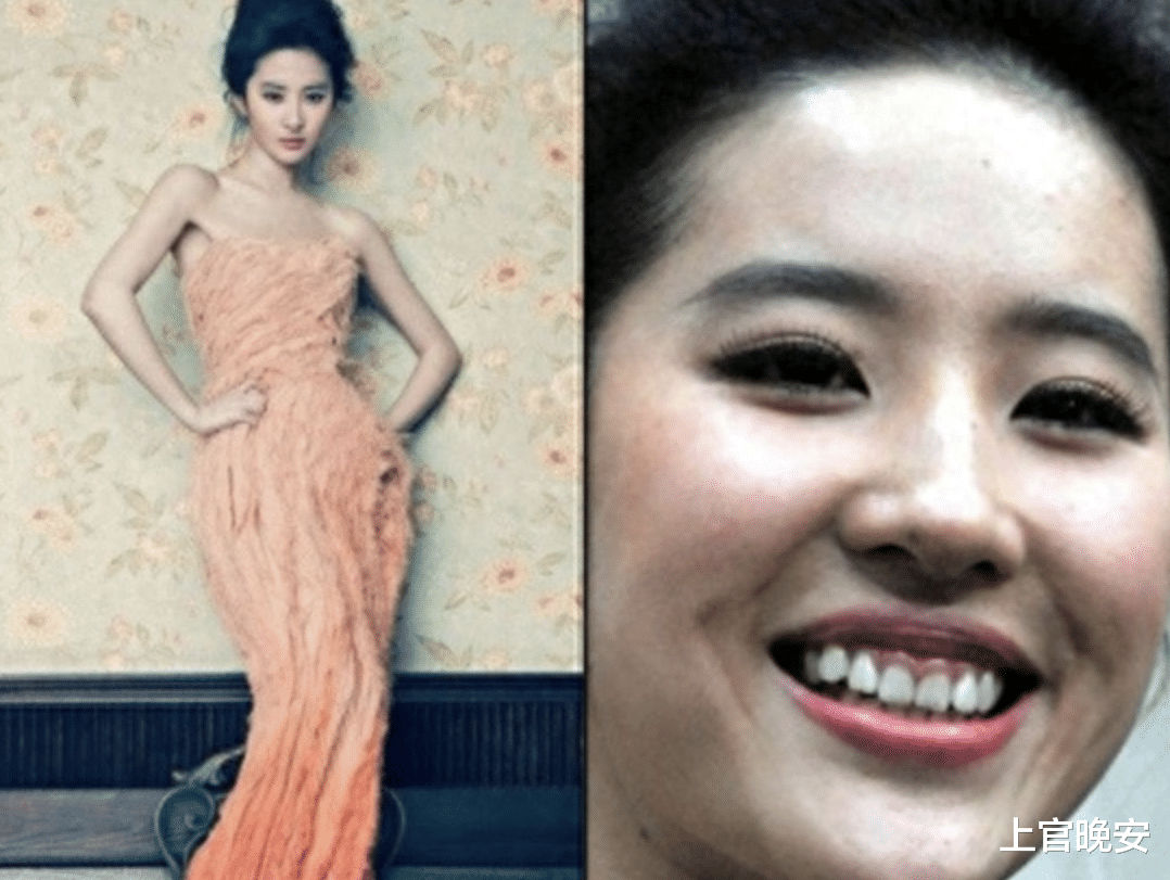 没眼看!嘴包不住牙,嘴凸,演戏难看,明星能不能放弃烤瓷牙审美