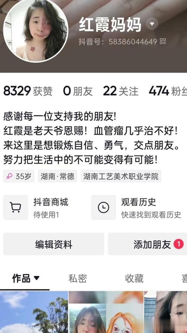 刘芳菲|我,因脸部有缺陷,找工作难,谈恋爱难,被嘲笑:将来谁会娶你