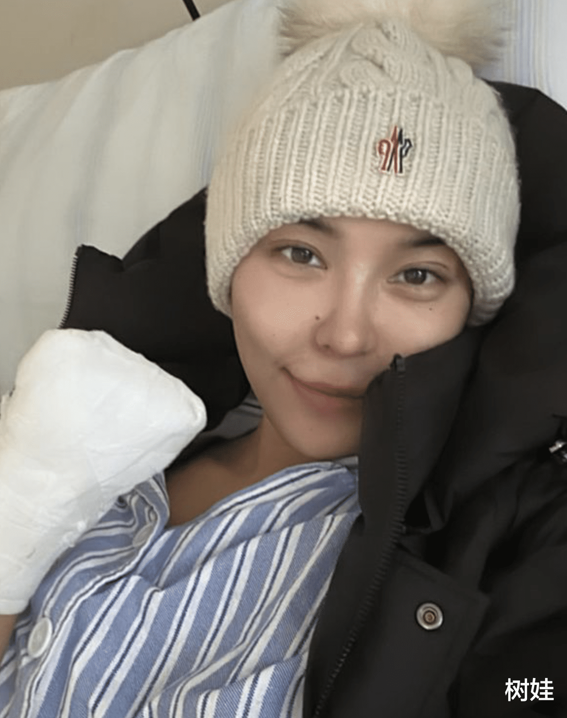 35岁内地模特自曝左手截肢,公开术后照片,面带笑容称已接受现状