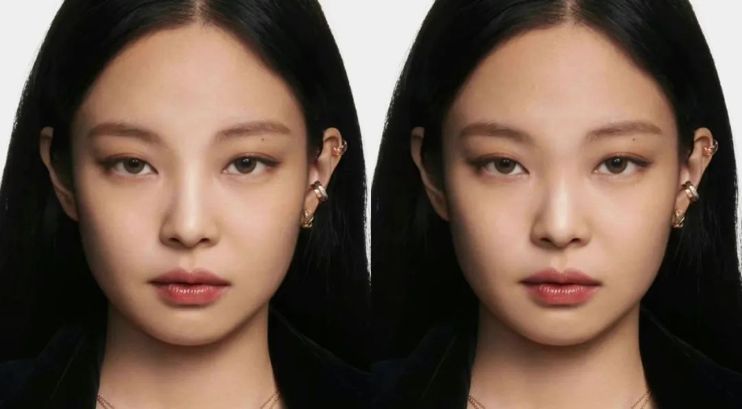 张雨绮的脸,怎么从千颂伊一夜间崩成蔡明了?