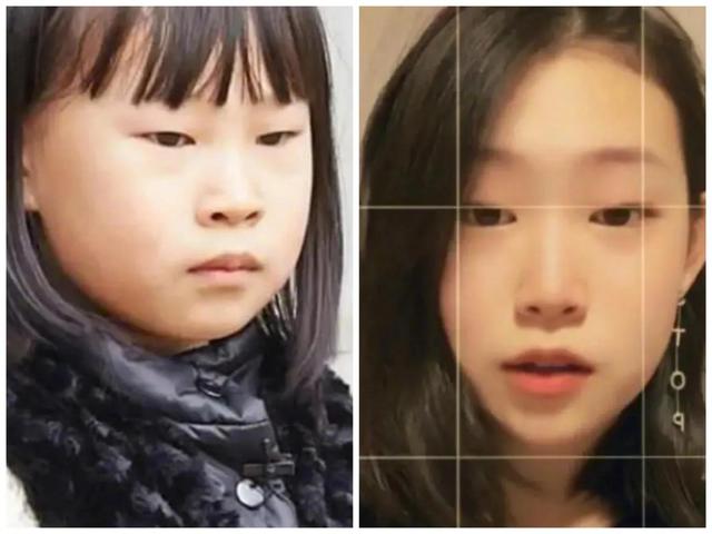 小沈阳|小沈阳三亚庆新年!头发稀少险秃头,38岁沈春阳黑色内衣太尴尬