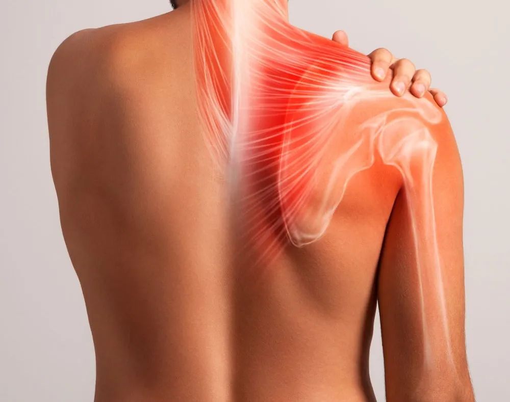 分享|健身后肩痛弹响,我是怎么好的?