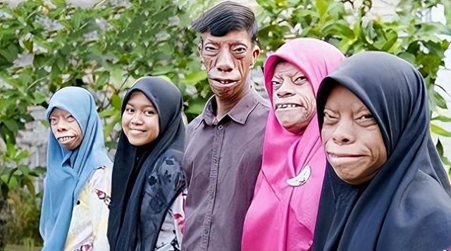 父亲基因太强大,一张“马脸”遗传全家,让儿女们苦不堪言