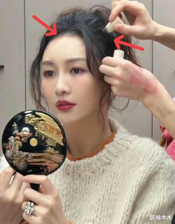 王鸥产后复工！发际线后退明显，曾被曝在私立医院生产，花费10万