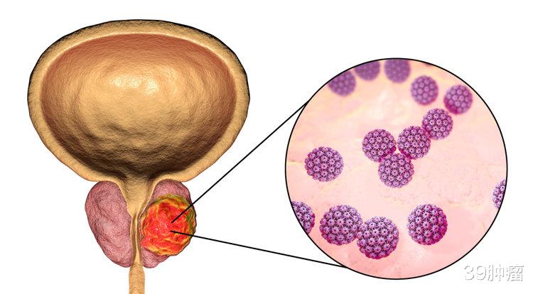 排尿很黄、异味很大?身体在向你暗示这5件事,可能和疾病有关