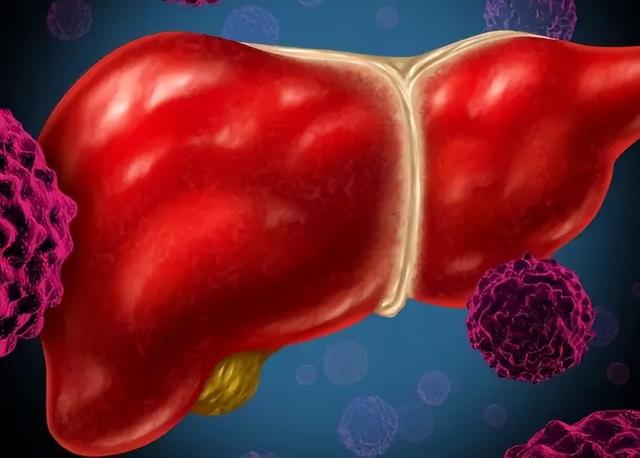 乙肝不能吃螃蟹？提醒：真正不能吃的食物，列成清单，值得收藏