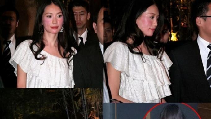 林志玲携丈夫外出聚餐，蓬头垢面引人担忧，丈夫微表情耐人寻味