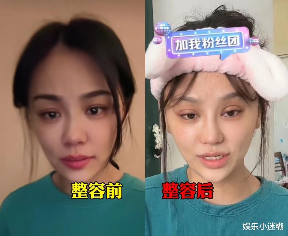 整容|樊小慧被疑精神出问题!蓬头垢面自曝整容,6岁儿子扒裤引争议
