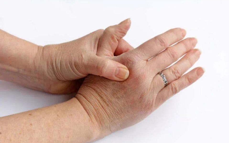 血栓|血栓来临并非“悄无声息”，提醒：手脚出现4个症状，别忽视