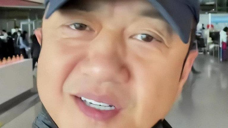 李亚鹏二婚女儿疑基因病加重，嘴巴、眼睛不对劲，海哈金喜表愧意