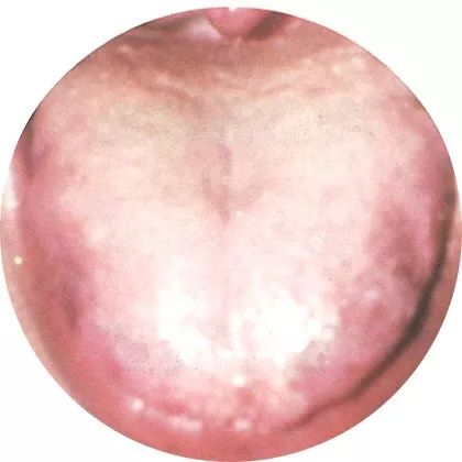 失眠|中医中的舌诊，了解吗