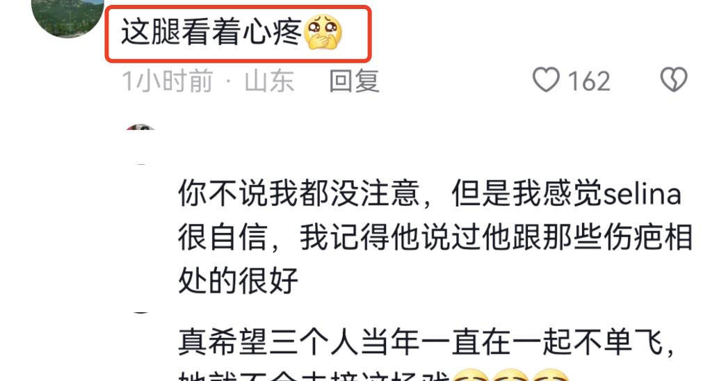 迪丽热巴|任家萱过母亲节罕见穿短裤,双腿烧伤疤痕暴露无遗