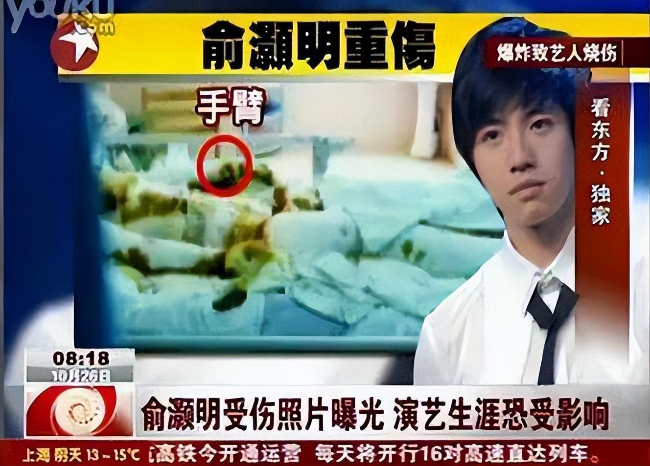 俞灏明：23岁毁容，被女友抛弃，公司放弃，如今大变身，是个狠人