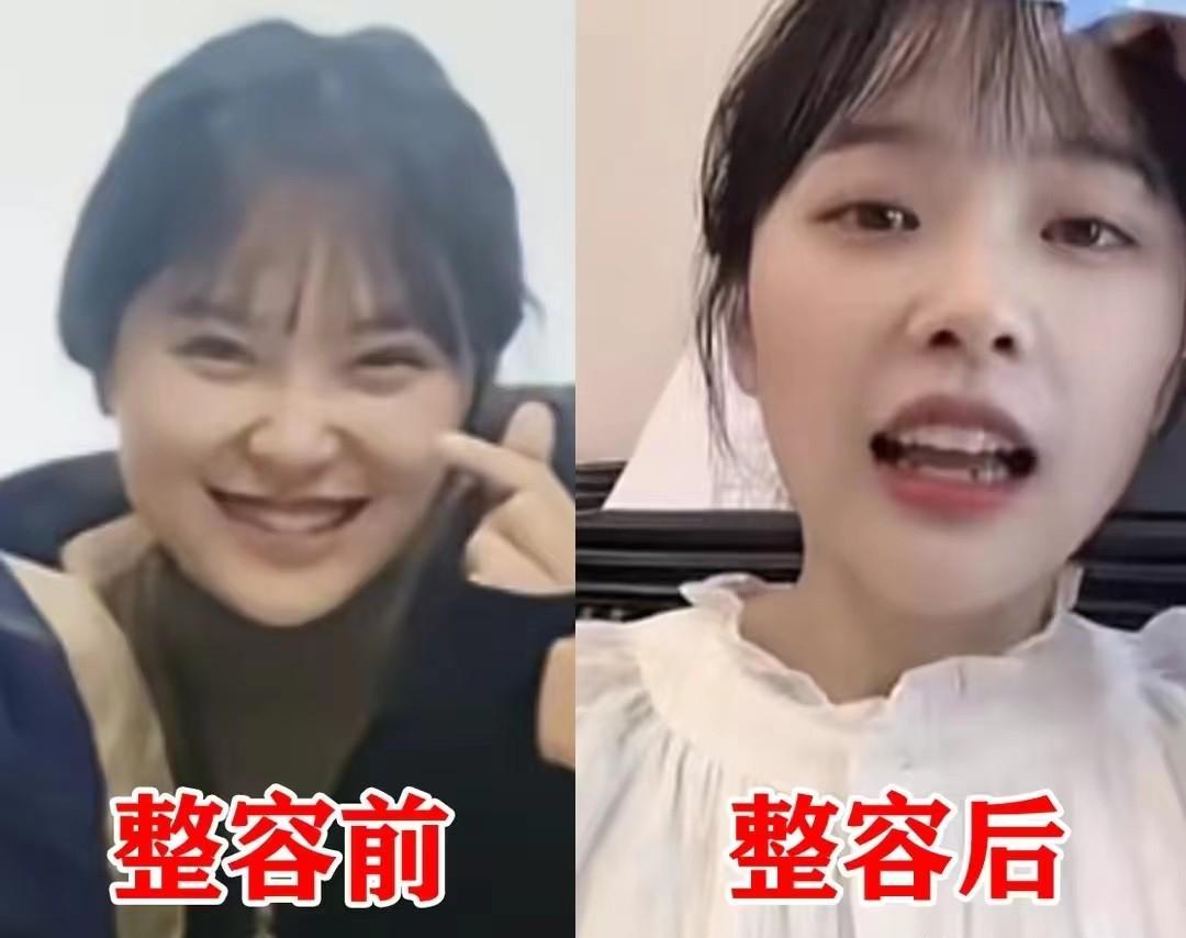 整容|“挖呀挖呀”黄老师遭遇网暴：38岁疑似整容