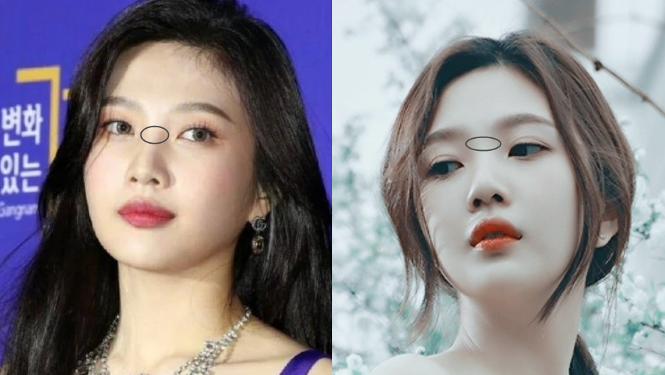 张雨绮的脸,怎么从千颂伊一夜间崩成蔡明了?