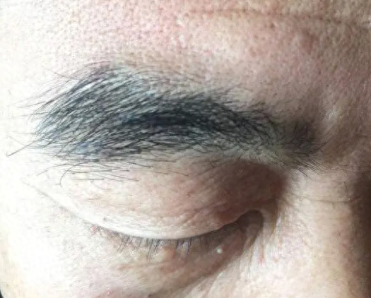 男性50岁以后眉毛变长，意味着什么？医生：建议了解