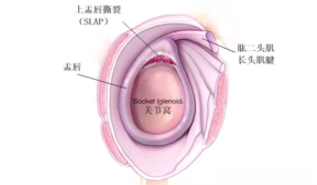 熬夜|肩膀疼痛是怎么回事?本文告知您6种病因,让您再也不盲目咨询