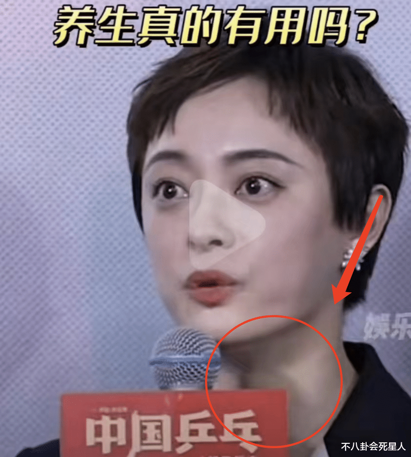 孙俪|眼凸、凶相、眼圈乌黑,孙俪怎么变成这样了?