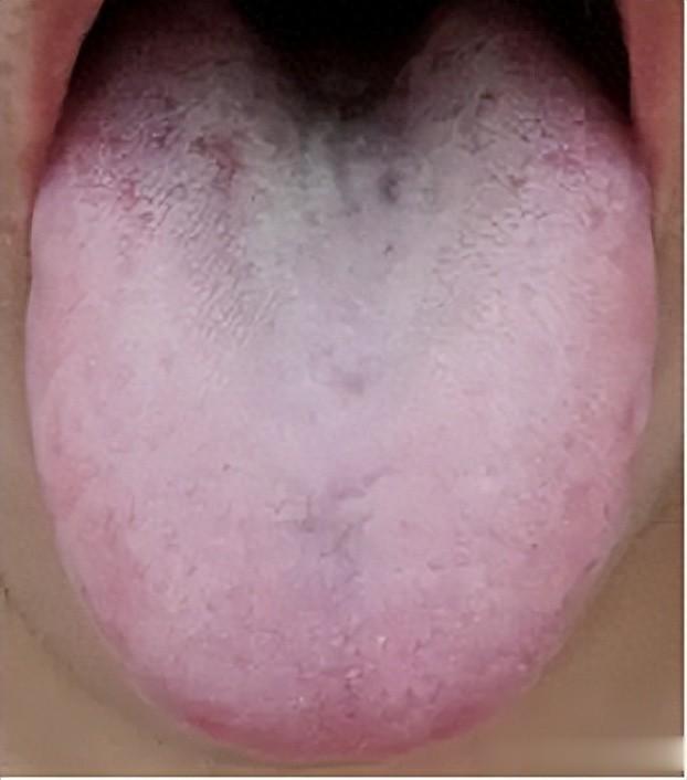 失眠多梦 睡觉盗汗，其实是肾阴虚，教你一招 再厉害的汗都不怕！