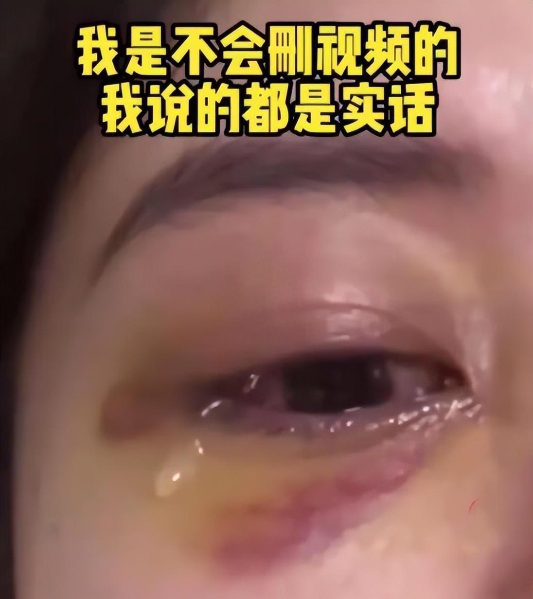 |越挖越深！好声音藏太阳旗，内娱集体失声，那英姐姐诉苦隐喻非常明显