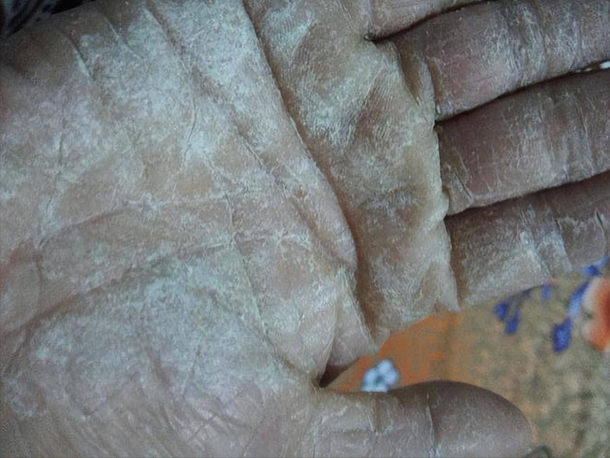 平价又好用的皲裂膏测评!干裂爆皮统统拿下!