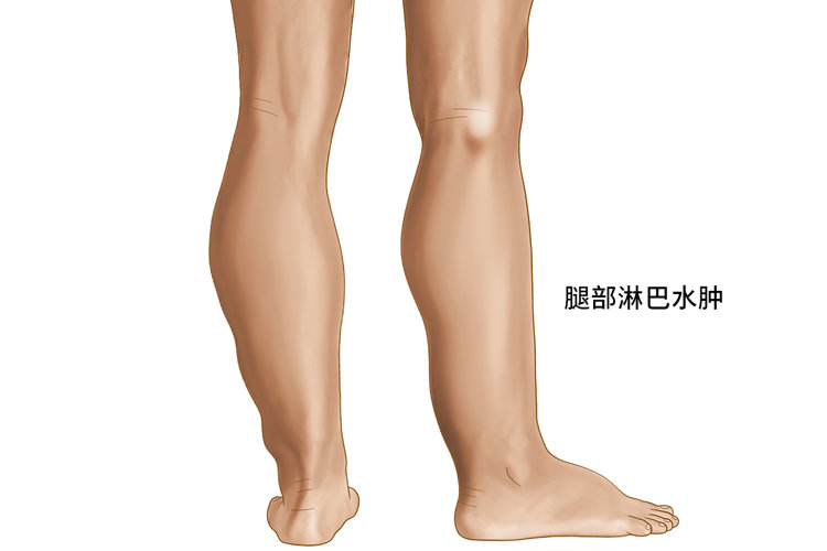 2岁男孩身患恶性肿瘤，父母含泪放弃治疗，3年后却发生奇迹