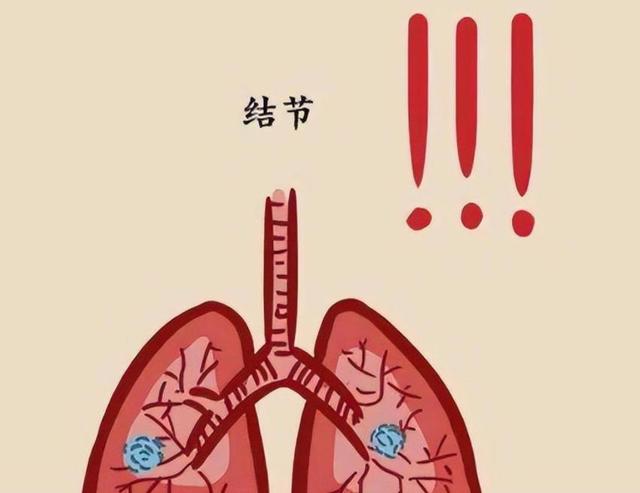 芹菜是结节的“加速剂”？医生提醒：不想结节癌变，尽量少吃4物