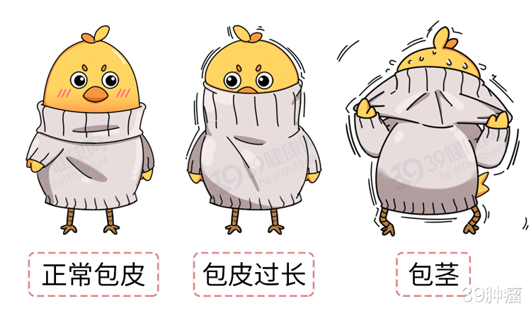 医生|被割下的“包皮”都去哪儿了？还能回收利用吗？为你揭秘