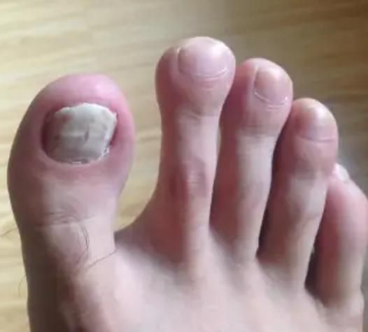 肝脏|伤肝的4种行为,奉劝大家尽早戒掉!