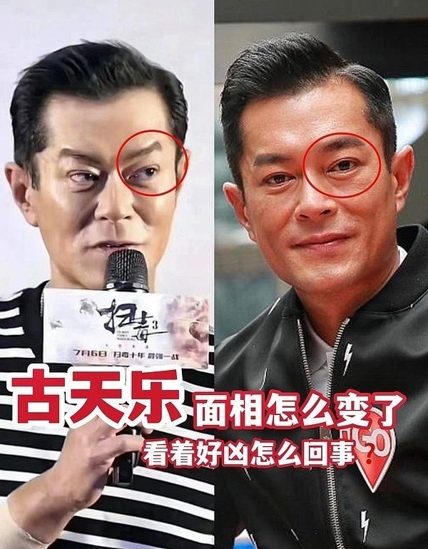 53岁古天乐近照遭吐槽凶神恶煞,被质疑打针拉皮过度导致医美失败