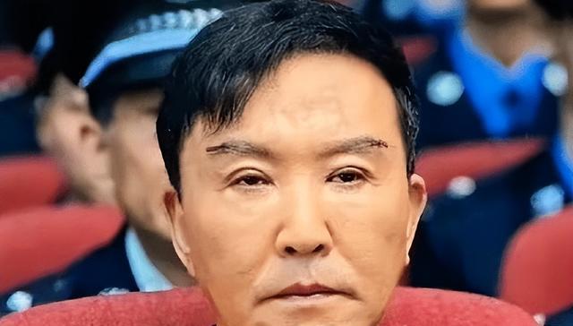 双眼皮别乱割，从景甜到戚薇，这些明星的“后遗症”出来了