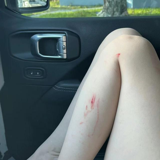 杨丽萍|25岁小彩旗受伤独居国外，被亲姨妈杨丽萍拿钱养着，是爱还是害？