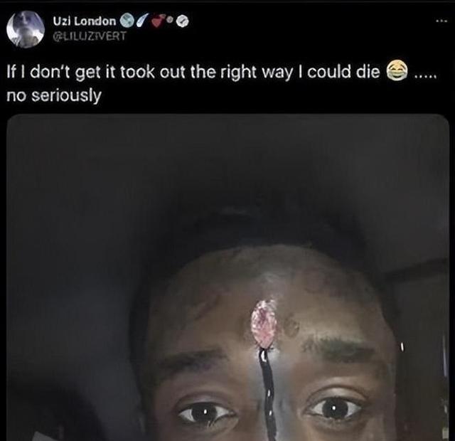 真是活久见,美国歌手将1.6亿粉钻镶额头,演唱时被粉丝徒手抠出