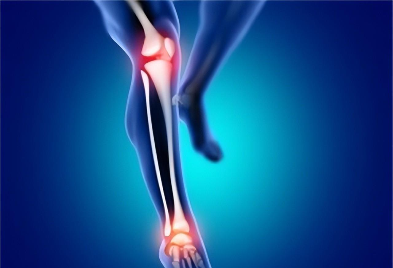 |尿酸高全身都受损,出现3种表现,可能是你尿酸高了,及时控制