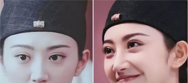 双眼皮别乱割，从景甜到戚薇，这些明星的“后遗症”出来了