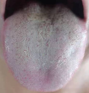 如何才能强壮海绵体?