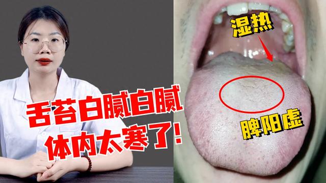 潘大夫舌诊：舌苔白腻白腻的，像是铺了一层粉，这个人体内太寒了