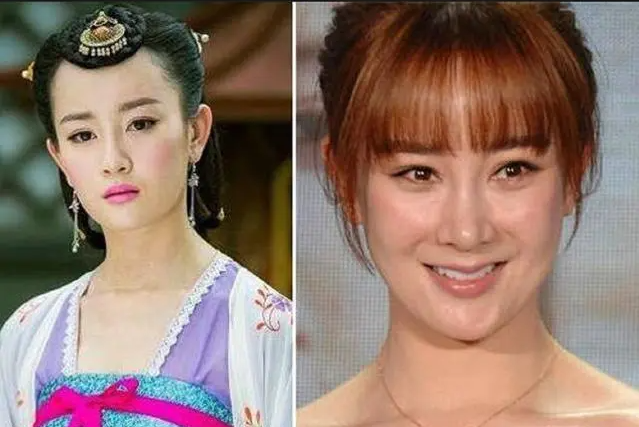 毁在医美的女星：彭丹像伏地魔，张檬“人身蛇脸”，王思懿认不出