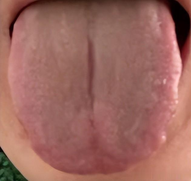 8味药壮宗筋,重用蜈蚣,走窜助起,活血助大