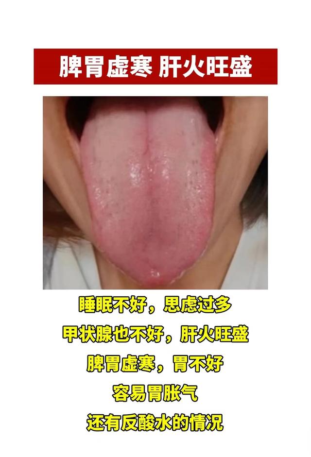 潘医生舌诊—实战分析：心血不足，寒湿重，寒湿盛，肝气不舒