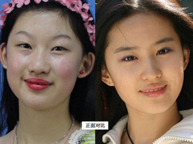 19岁少女执意整成“刘亦菲”,连名字也高仿,8年后她现状怎样?