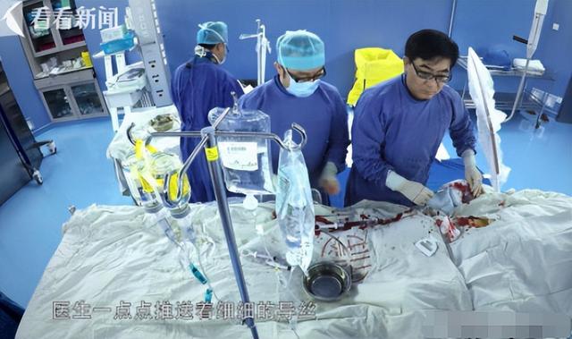回顾：19岁女孩心脏手术做一半，医生却突然手抽筋，后来怎样了